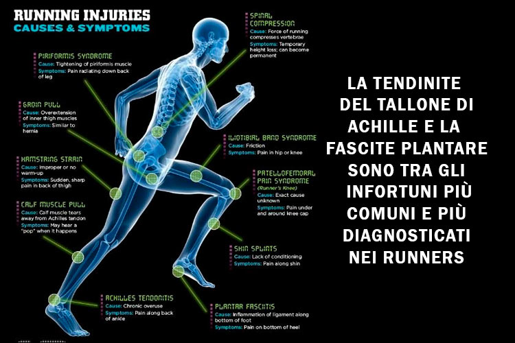 Gli infortuni più frequenti nel running