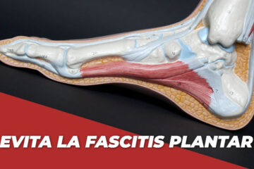 Evita la fascitis plantar