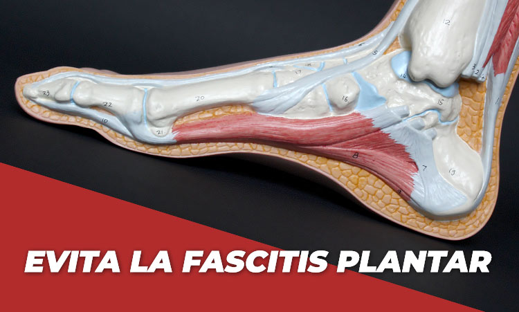 Evita la fascitis plantar