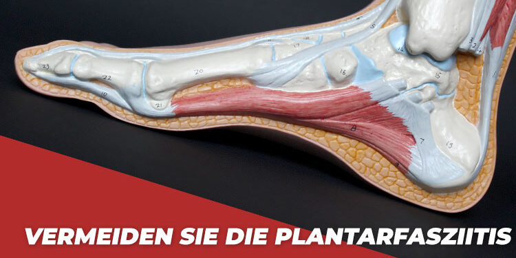 Plantarfasziitis