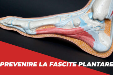 FASCITE PLANTARE