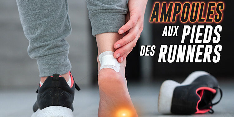 ampoules aux pieds