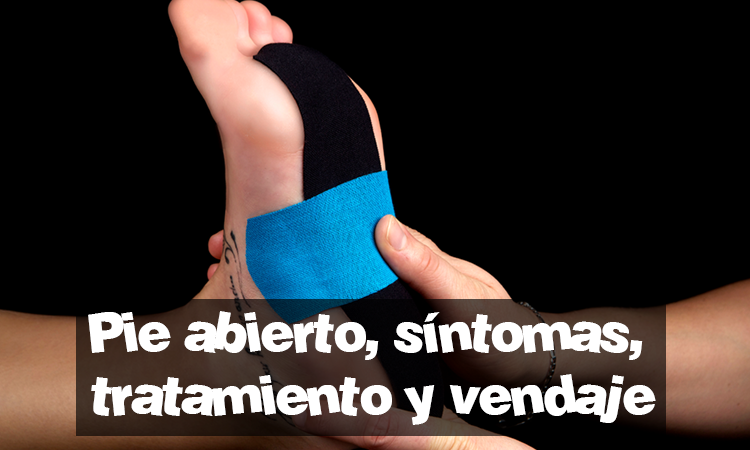 Pie abierto s ntomas tratamiento y vendaje StreetProRunning Blog
